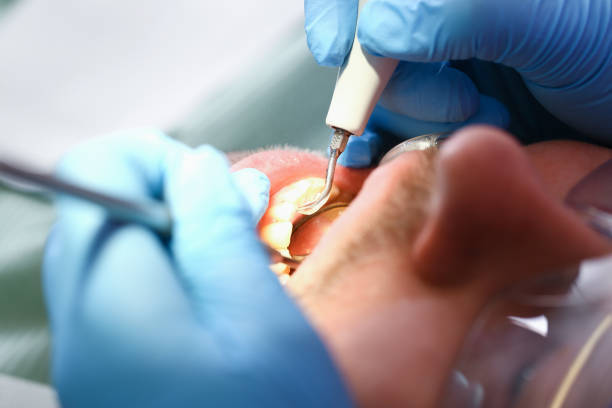 Best Emergency Dental Care for Trauma or Injury in Beach City, TX