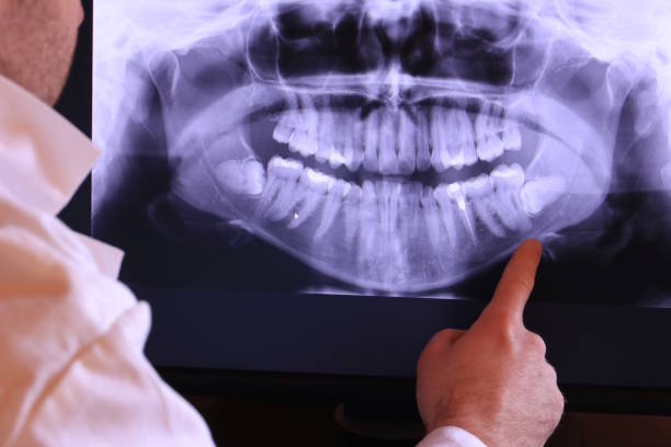 Best Emergency Dental Surgery in Beach City, TX